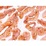 Immunohistochemistry - Anti-pan Cytokeratin Antibody [SPM583] - BSA and Azide free (A254082) - Antibodies.com