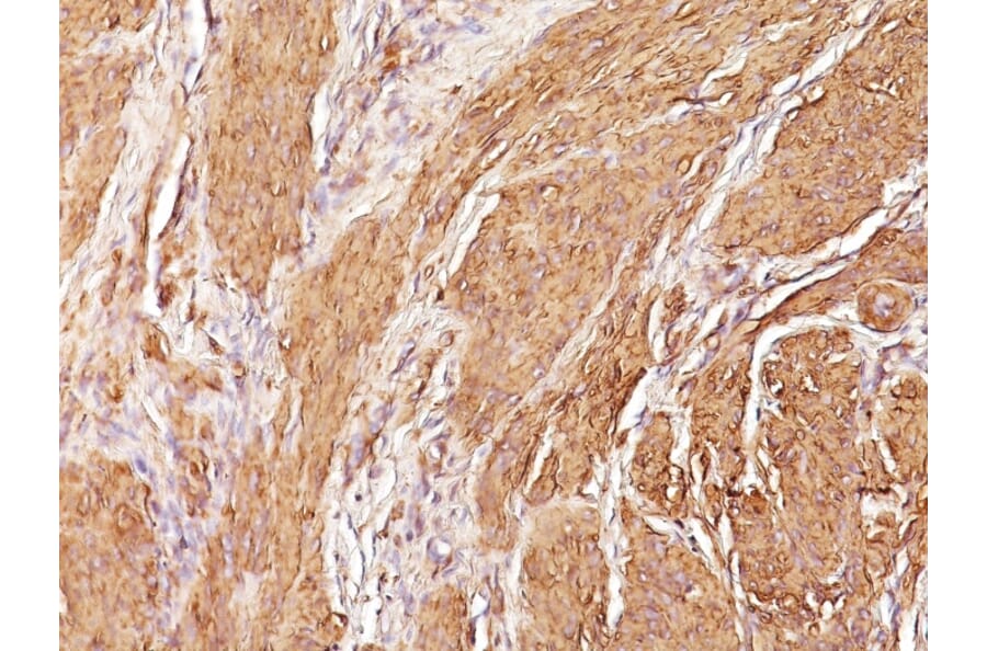 Immunohistochemistry - Anti-Muscle Actin Antibody [SPM160] - BSA and Azide free (A254084) - Antibodies.com