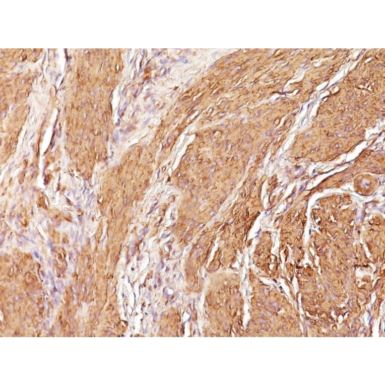 Immunohistochemistry - Anti-Muscle Actin Antibody [SPM160] - BSA and Azide free (A254084) - Antibodies.com