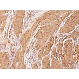 Immunohistochemistry - Anti-Muscle Actin Antibody [SPM160] - BSA and Azide free (A254084) - Antibodies.com