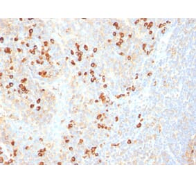 Immunohistochemistry - Anti-Plasma Cell Antibody [SPM310] - BSA and Azide free (A254086) - Antibodies.com