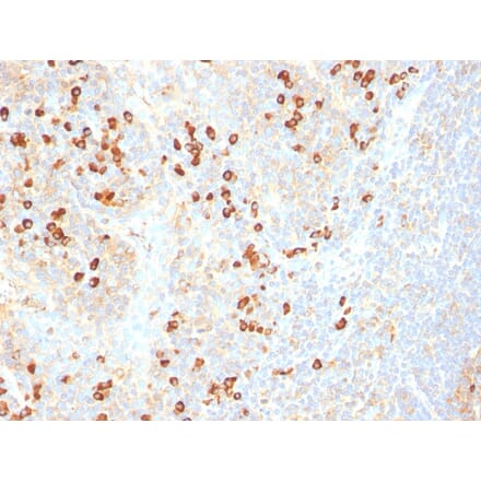 Immunohistochemistry - Anti-Plasma Cell Antibody [SPM310] - BSA and Azide free (A254086) - Antibodies.com