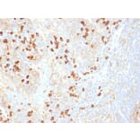 Immunohistochemistry - Anti-Plasma Cell Antibody [SPM310] - BSA and Azide free (A254086) - Antibodies.com