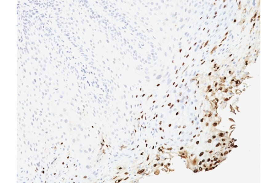 Immunohistochemistry - Anti-HPV16 L1 Antibody [SPM257] - BSA and Azide free (A254087) - Antibodies.com