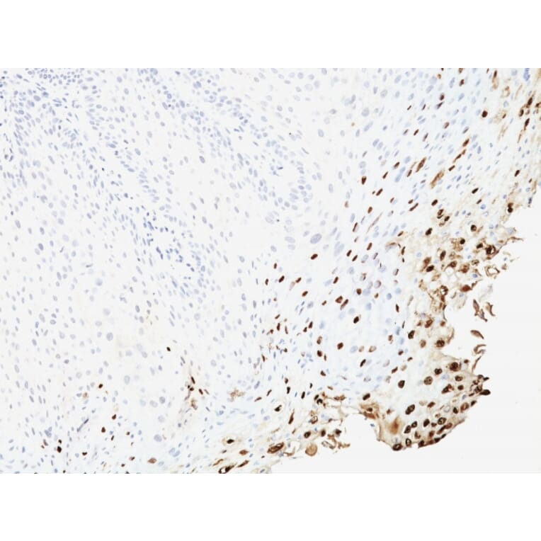 Immunohistochemistry - Anti-HPV16 L1 Antibody [SPM257] - BSA and Azide free (A254087) - Antibodies.com