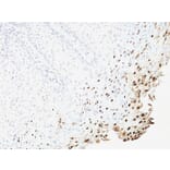 Immunohistochemistry - Anti-HPV16 L1 Antibody [SPM257] - BSA and Azide free (A254087) - Antibodies.com