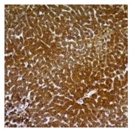 Immunohistochemistry - Anti-Hepatocyte Specific Antigen Antibody [SPM582] - BSA and Azide free (A254089) - Antibodies.com