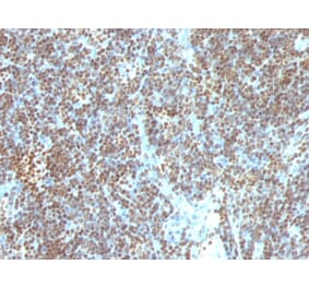 Immunohistochemistry - Anti-ds DNA Antibody [SPM603] - BSA and Azide free (A254091) - Antibodies.com
