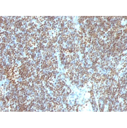 Immunohistochemistry - Anti-ds DNA Antibody [SPM603] - BSA and Azide free (A254091) - Antibodies.com