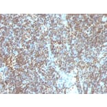 Immunohistochemistry - Anti-ds DNA Antibody [SPM603] - BSA and Azide free (A254091) - Antibodies.com