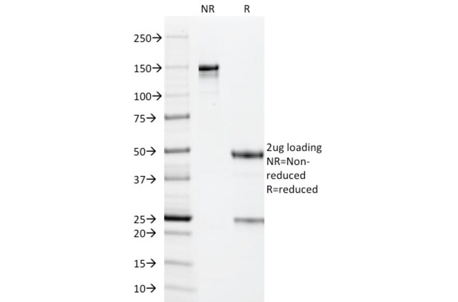 SDS-PAGE - Anti-Cytomegalovirus p65 Antibody [CMV101] - BSA and Azide free (A254094) - Antibodies.com
