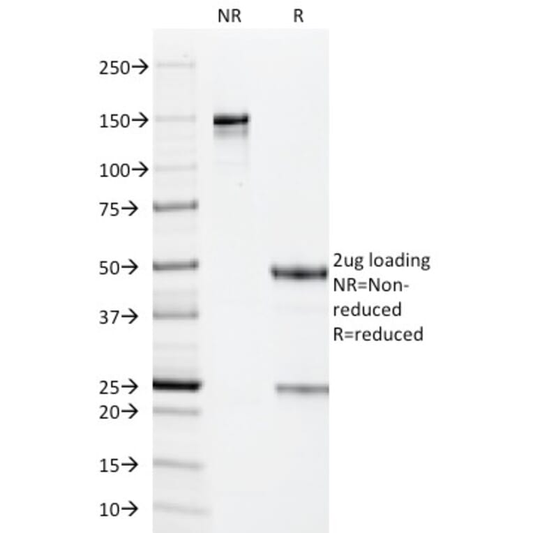SDS-PAGE - Anti-Cytomegalovirus p65 Antibody [CMV101] - BSA and Azide free (A254094) - Antibodies.com