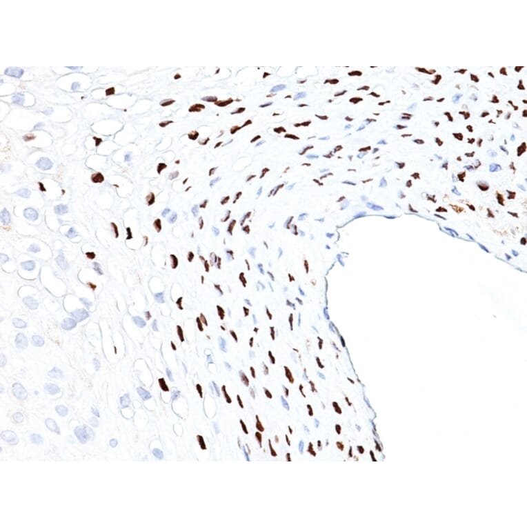 Immunohistochemistry - Anti-HPV16 L1 Antibody [HPV16L1/1058] - BSA and Azide free (A254095) - Antibodies.com