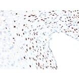 Immunohistochemistry - Anti-HPV16 L1 Antibody [HPV16L1/1058] - BSA and Azide free (A254095) - Antibodies.com