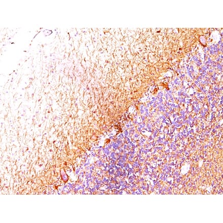 Immunohistochemistry - Anti-Neurofilament Heavy Polypeptide Antibody [RT-97 + NR-4] - BSA and Azide free (A254097) - Antibodies.com