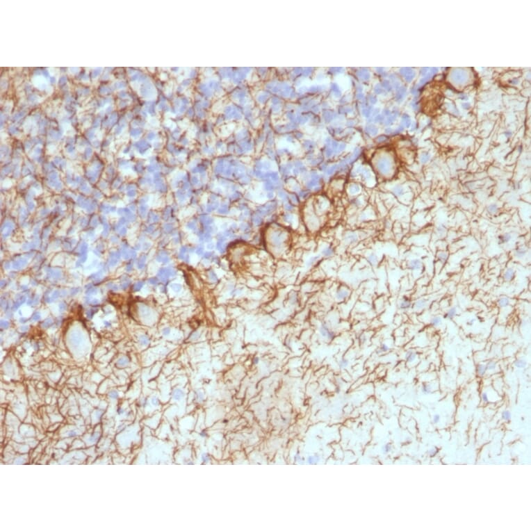 Immunohistochemistry - Anti-Neurofilament Heavy Polypeptide Antibody [RT-97 + NR-4] - BSA and Azide free (A254097) - Antibodies.com