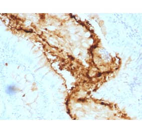 Immunohistochemistry - Anti-Blood Group Lewis y Antibody [A70-A/A9] - BSA and Azide free (A254097) - Antibodies.com
