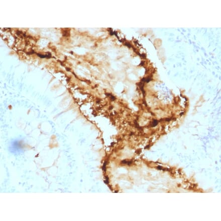 Immunohistochemistry - Anti-Blood Group Lewis y Antibody [A70-A/A9] - BSA and Azide free (A254097) - Antibodies.com