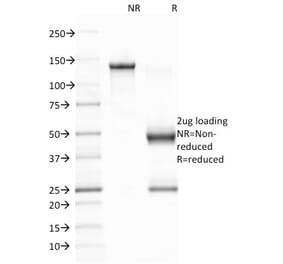 SDS-PAGE - Anti-EBV Latent Membrane Protein 1 Antibody [CS1] - BSA and Azide free (A254098) - Antibodies.com