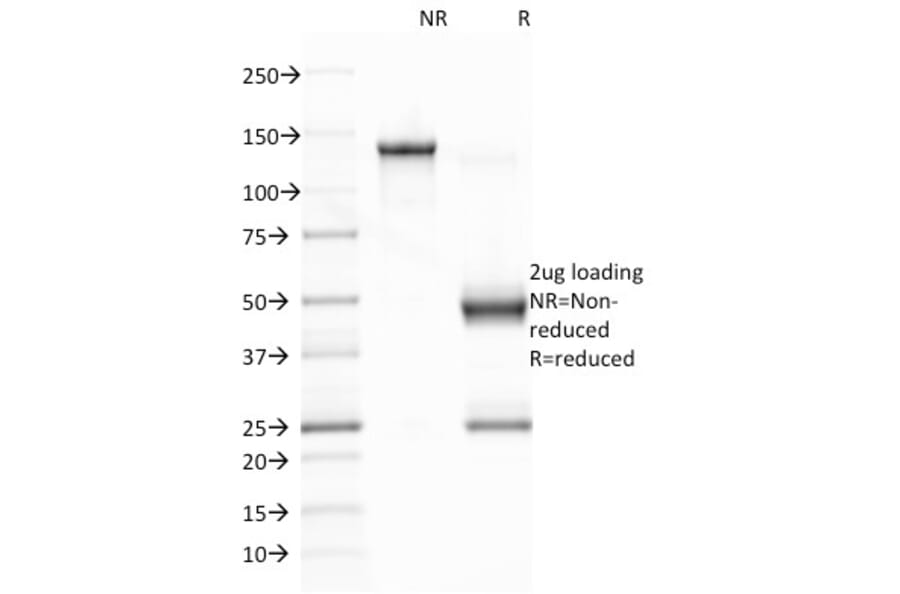 SDS-PAGE - Anti-EBV Latent Membrane Protein 1 Antibody [CS1] - BSA and Azide free (A254098) - Antibodies.com