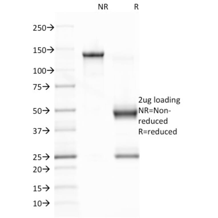 SDS-PAGE - Anti-EBV Latent Membrane Protein 1 Antibody [CS1] - BSA and Azide free (A254098) - Antibodies.com