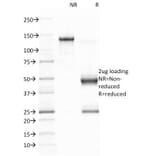 SDS-PAGE - Anti-EBV Latent Membrane Protein 1 Antibody [CS1] - BSA and Azide free (A254098) - Antibodies.com