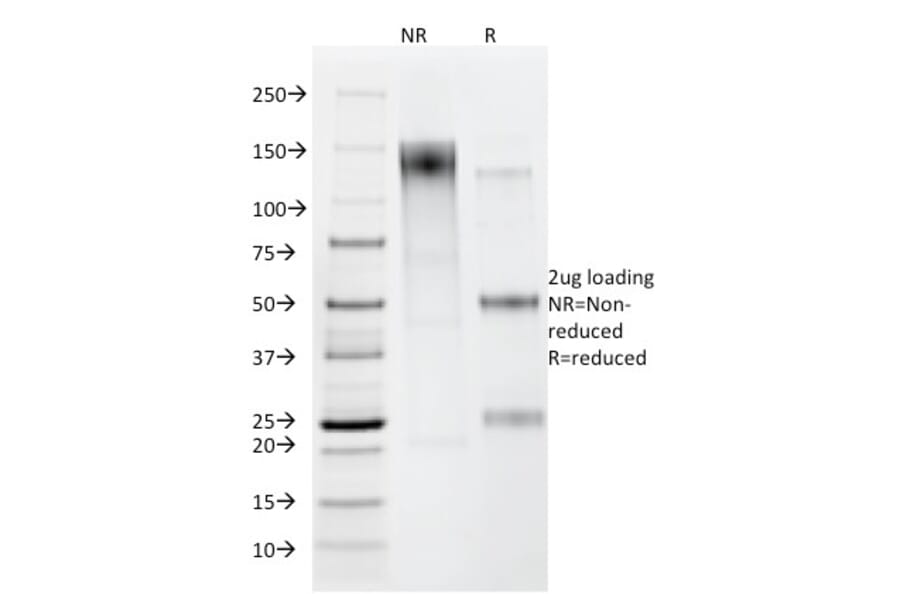 SDS-PAGE - Anti-Helicobacter pylori Antibody [HP/212] - BSA and Azide free (A254100) - Antibodies.com