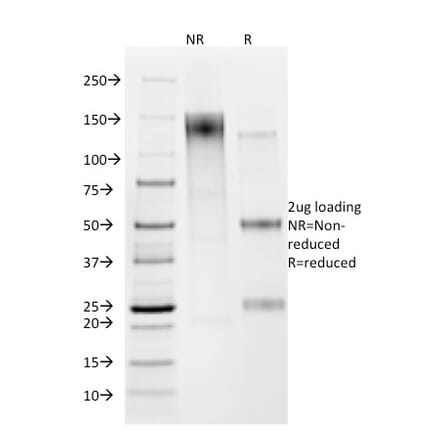 SDS-PAGE - Anti-Helicobacter pylori Antibody [HP/212] - BSA and Azide free (A254100) - Antibodies.com