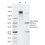 SDS-PAGE - Anti-Helicobacter pylori Antibody [HP/212] - BSA and Azide free (A254100) - Antibodies.com