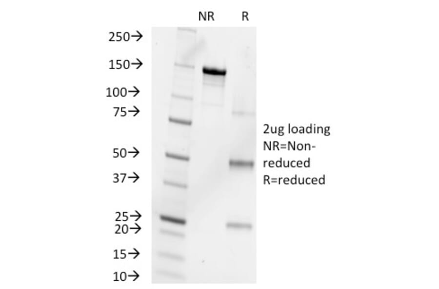 SDS-PAGE - Anti-Progesterone Antibody [6-5E-10B] - BSA and Azide free (A254101) - Antibodies.com