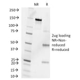 SDS-PAGE - Anti-Progesterone Antibody [6-5E-10B] - BSA and Azide free (A254101) - Antibodies.com