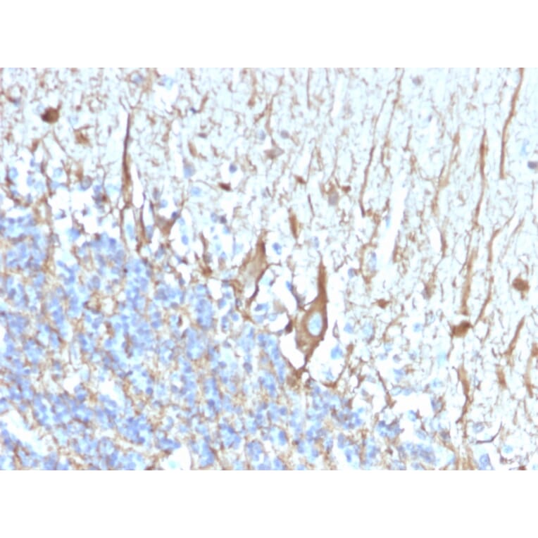 Immunohistochemistry - Anti-Neurofilament Heavy Polypeptide Antibody [2F11] (A254102) - Antibodies.com