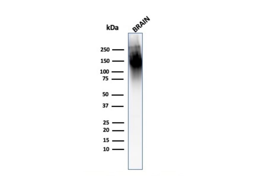 Western Blot - Anti-Neurofilament Heavy Polypeptide Antibody [2F11] (A254103) - Antibodies.com