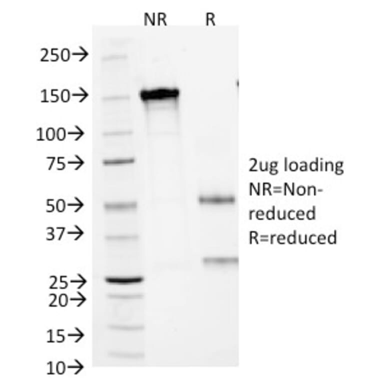 SDS-PAGE - Anti-Small Cell Lung Carcinoma Antigen Antibody [MOC-52] - BSA and Azide free (A254103) - Antibodies.com
