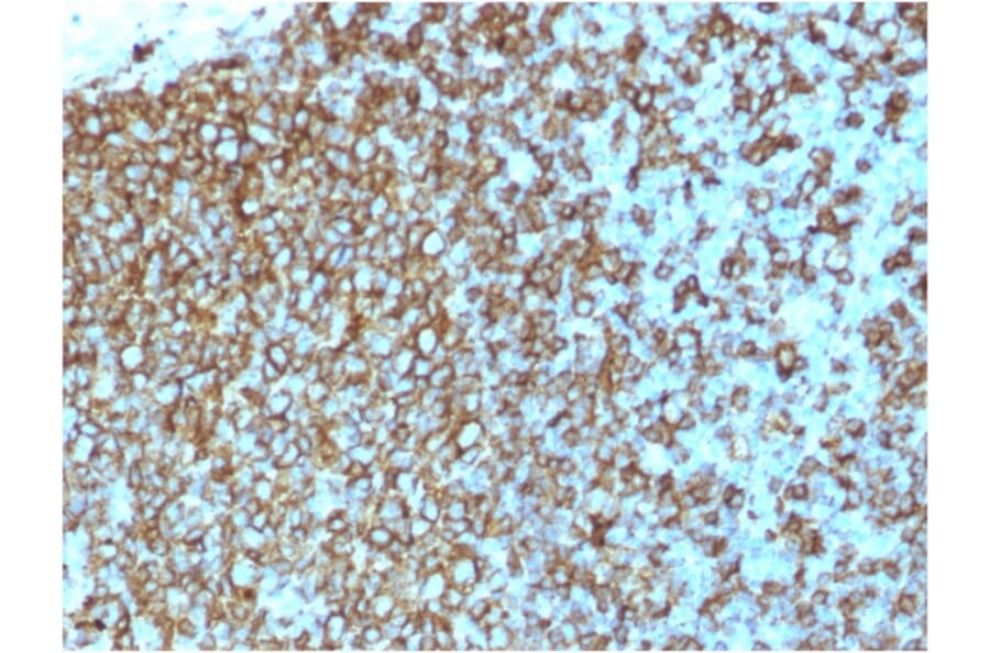 Immunohistochemistry - Anti-HLA DP + DQ + DR Antibody [rHLA-Pan/3475] - BSA and Azide free (A254105) - Antibodies.com