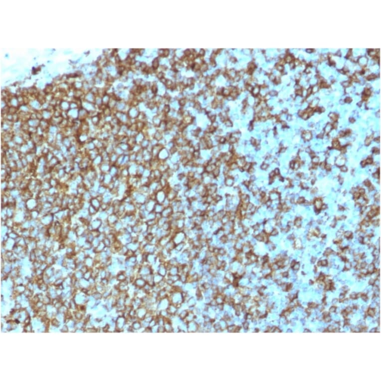 Immunohistochemistry - Anti-HLA DP + DQ + DR Antibody [rHLA-Pan/3475] - BSA and Azide free (A254105) - Antibodies.com