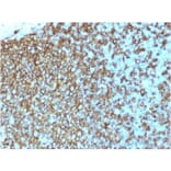 Immunohistochemistry - Anti-HLA DP + DQ + DR Antibody [rHLA-Pan/3475] - BSA and Azide free (A254105) - Antibodies.com