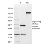 SDS-PAGE - Anti-HLA DP + DQ + DR Antibody [rHLA-Pan/3475] - BSA and Azide free (A254105) - Antibodies.com
