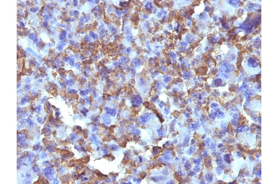 Immunohistochemistry - Anti-Macrophage + Histiocytoma Antibody [D11] - BSA and Azide free (A254105) - Antibodies.com