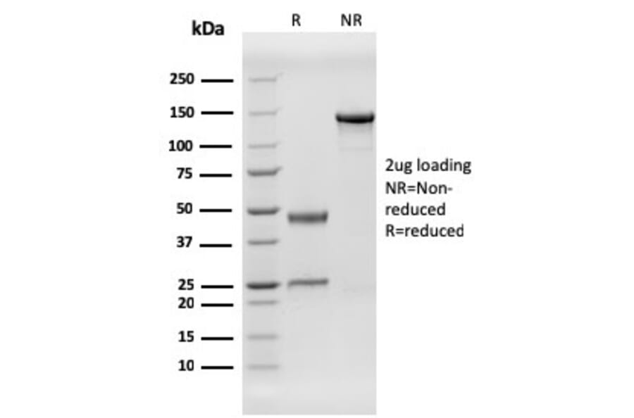 SDS-PAGE - Anti-HHV8 LNA-1 Antibody [HHV8/3606] - BSA and Azide free (A254107) - Antibodies.com