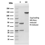 SDS-PAGE - Anti-HHV8 LNA-1 Antibody [HHV8/3606] - BSA and Azide free (A254107) - Antibodies.com