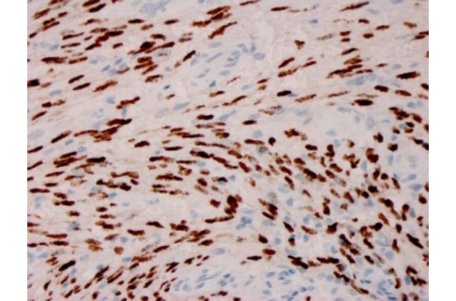 Immunohistochemistry - Anti-HHV8 LNA-1 Antibody [HHV8/3606] - BSA and Azide free (A254106) - Antibodies.com