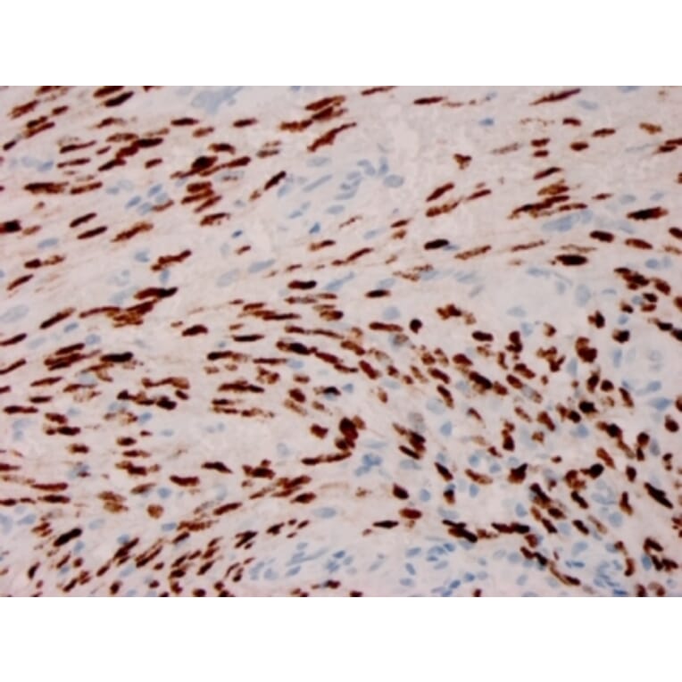 Immunohistochemistry - Anti-HHV8 LNA-1 Antibody [HHV8/3606] - BSA and Azide free (A254106) - Antibodies.com
