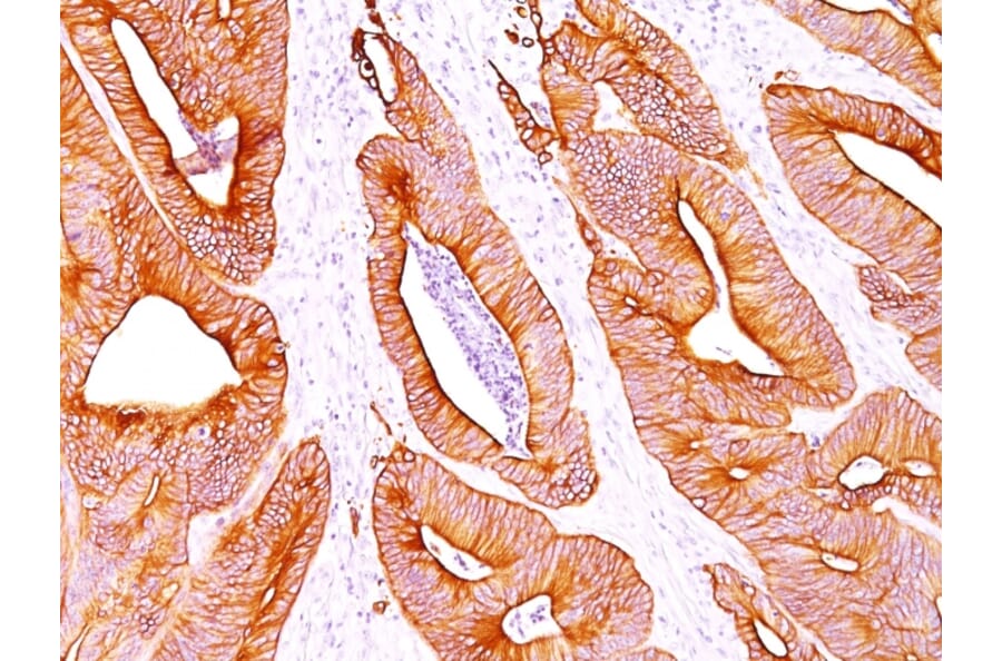 Immunohistochemistry - Anti-pan Cytokeratin Antibody [AE-1/AE-3] - BSA and Azide free (A254108) - Antibodies.com