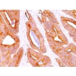 Immunohistochemistry - Anti-pan Cytokeratin Antibody [AE-1/AE-3] - BSA and Azide free (A254108) - Antibodies.com
