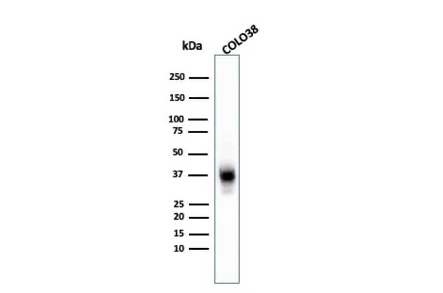Western Blot - Anti-Melanoma Marker (MART-1 + Tyrosinase + gp100) Antibody [A103 + T311 + HMB45] - BSA and Azide free (A254112) - Antibodies.com