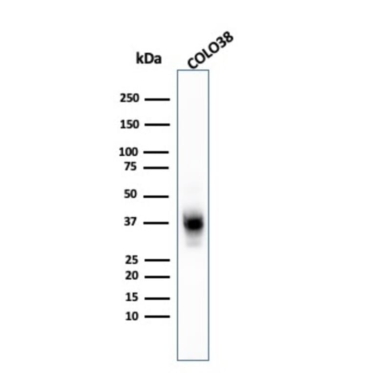 Western Blot - Anti-Melanoma Marker (MART-1 + Tyrosinase + gp100) Antibody [A103 + T311 + HMB45] - BSA and Azide free (A254112) - Antibodies.com