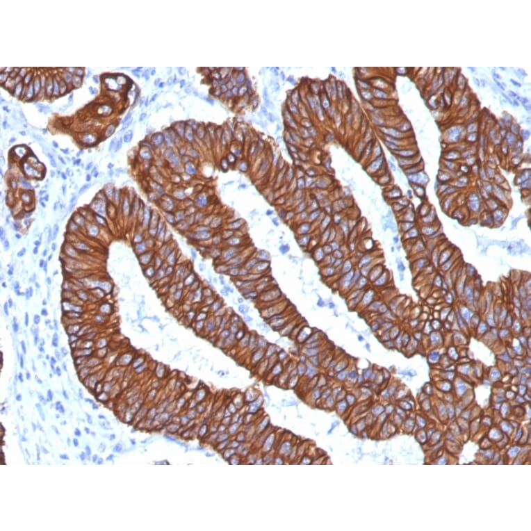 Immunohistochemistry - Anti-Cytokeratin 8 + 18 Antibody [KRT8.18/1346] - BSA and Azide free (A254112) - Antibodies.com