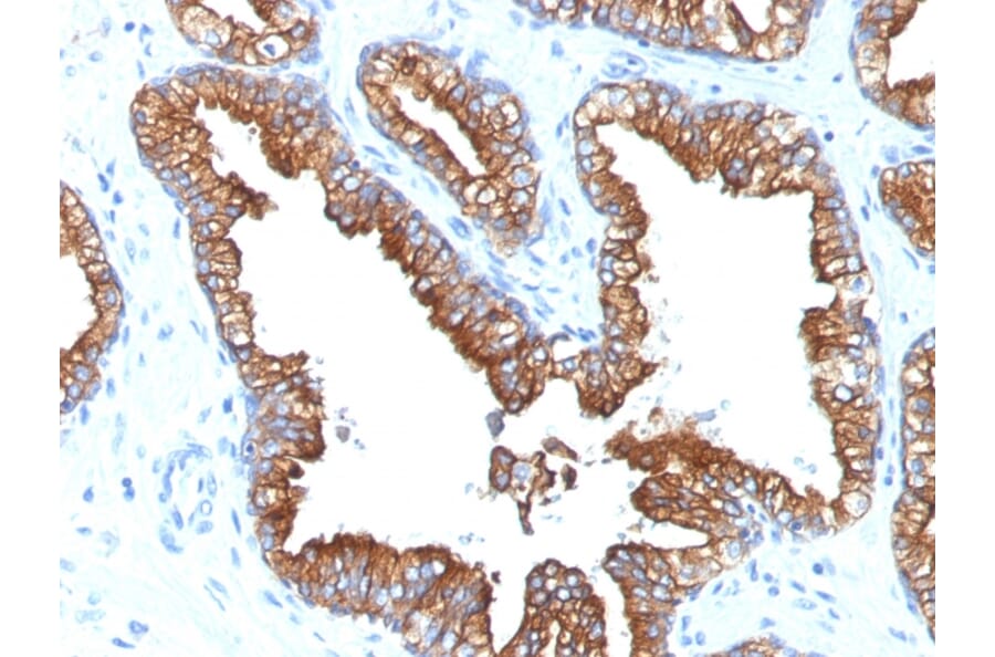 Immunohistochemistry - Anti-Cytokeratin 8 + 18 Antibody [KRT8.18/1346] - BSA and Azide free (A254113) - Antibodies.com