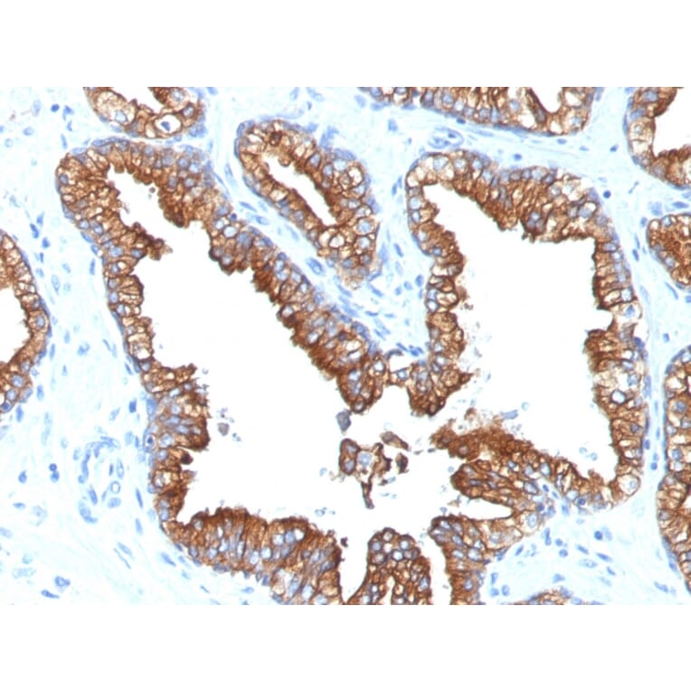 Immunohistochemistry - Anti-Cytokeratin 8 + 18 Antibody [KRT8.18/1346] - BSA and Azide free (A254113) - Antibodies.com